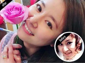 明星的牙齿都怎么做的,揭秘明星牙齿美容的神奇之旅